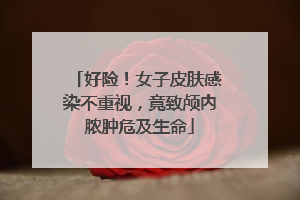 好险！女子皮肤感染不重视，竟致颅内脓肿危及生命